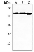 Anti-C16orf71 Antibody