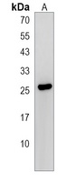 Anti-LRRC61 Antibody