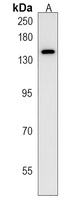 Anti-PCDH11Y Antibody