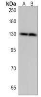 Anti-SGSM1 Antibody
