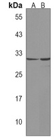 Anti-ASB11 Antibody