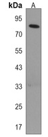 Anti-CMIP Antibody