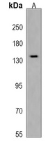 Anti-ATP8B3 Antibody