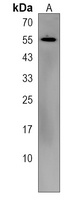 Anti-KRT86 Antibody