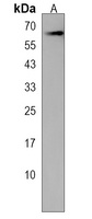 Anti-CHRNB4 Antibody