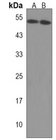 Anti-PCOLCE2 Antibody