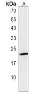 Anti-LIN7B Antibody