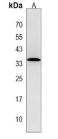 Anti-OR6S1 Antibody