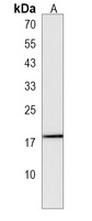 Anti-MYL12B Antibody