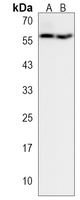 Anti-TMX3 Antibody