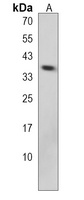 Anti-OR52J3 Antibody
