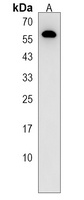 Anti-ZNF205 Antibody