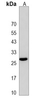 Anti-PEBP4 Antibody