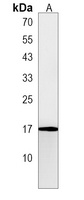 Anti-PLAC1 Antibody