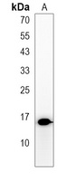 Anti-HIGD1C Antibody