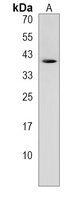 Anti-CTRB1 Antibody