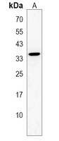 Anti-AMMECR1 Antibody