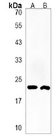 Anti-HSPB9 Antibody