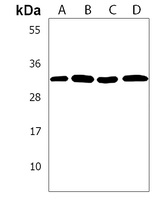 Anti-EXOSC6 Antibody