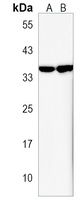 Anti-OR5AK2 Antibody
