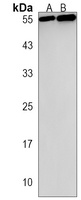 Anti-TBX4 Antibody