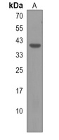 Anti-VSIG4 Antibody