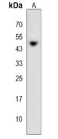 Anti-PRAMEF11 Antibody