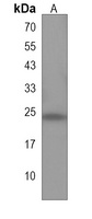 Anti-KLRF2 Antibody