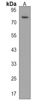 Anti-HECTD2 Antibody