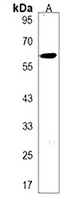 Anti-TRPC4AP Antibody