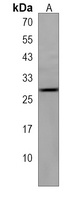 Anti-IGLL5 Antibody