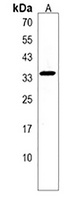 Anti-FAHD2B Antibody