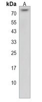 Anti-ZNF416 Antibody