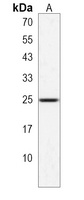 Anti-PRELID1 Antibody