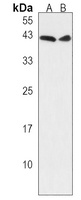 Anti-GIPC3 Antibody