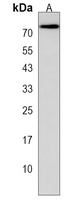 Anti-KLHL28 Antibody