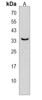 Anti-SDR39U1 Antibody