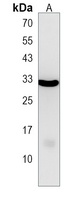 Anti-NKX6-2 Antibody