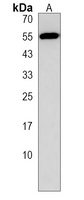 Anti-FRMD8 Antibody