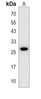 Anti-CIDEC Antibody