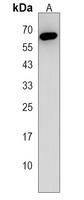 Anti-PPIL2 Antibody