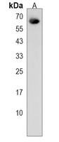 Anti-DYTN Antibody