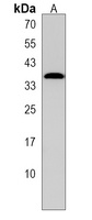 Anti-GPATCH11 Antibody