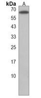 Anti-PYROXD2 Antibody