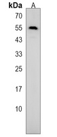 Anti-EEPD1 Antibody