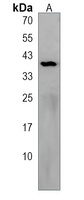 Anti-MMD2 Antibody