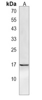 Anti-GLIPR2 Antibody