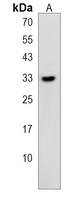 Anti-TIPRL Antibody