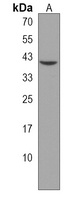 Anti-QPCTL Antibody