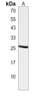 Anti-MRGBP Antibody